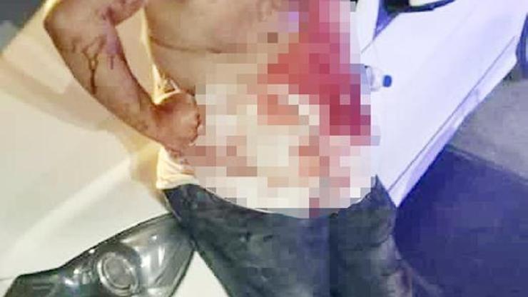 Gazipaşada silahlı kavga: 1 yaralı