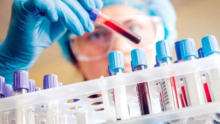 Anti Hbs Nedir, Kaç Olmalıdır Anti Hbs Değeri Yüksekliği Ve Düşüklüğü Ne Anlama Gelir