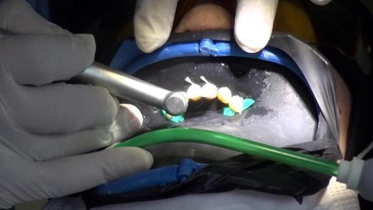 Pandemi diş tedavinize engel olmasın