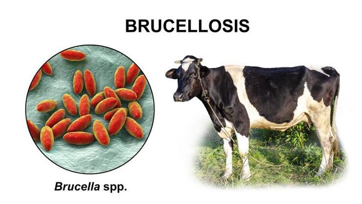 Brusella Hastalığı Nedir, Nasıl Bulaşır Brusella Tedavisi Nasıl Yapılır