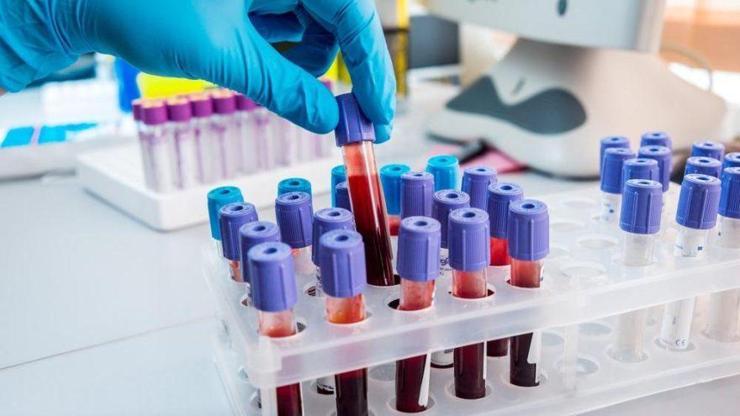 Mchc Nedir, Normal Değeri Kaç Olmalıdır Mch Yüksekliği Ve Düşüklüğü Neden Olur