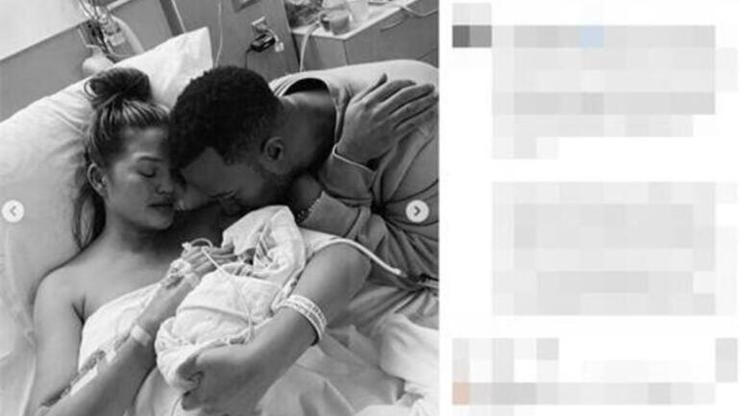Chrissy Teigen yanaklarındaki yağları aldırdı