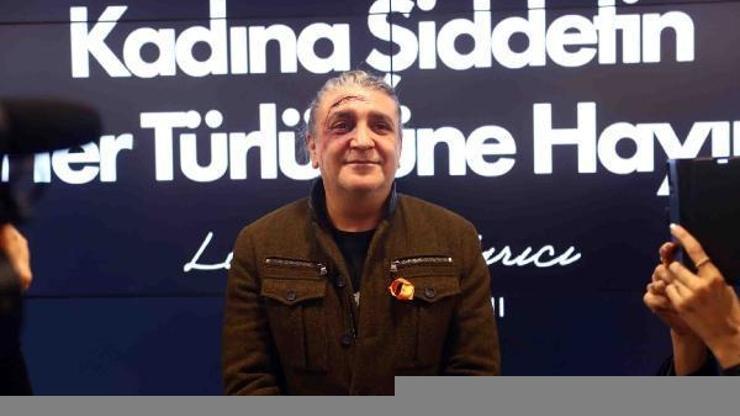Kadın radyocular kadına şiddeti makyajla anlattılar