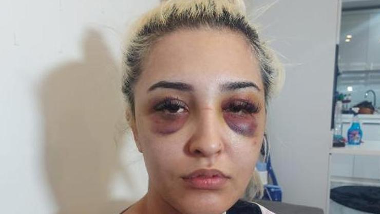 Eski sevgilisini feci şekilde dövüp, 2 saat uyuyalım, gideceğim demiş