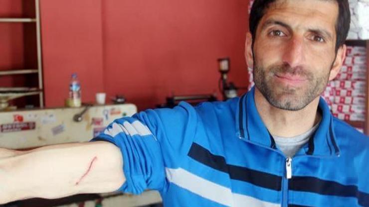 Futbol maçında dayak yiyen Suriyeli kaleci: Psikolojim bozuldu