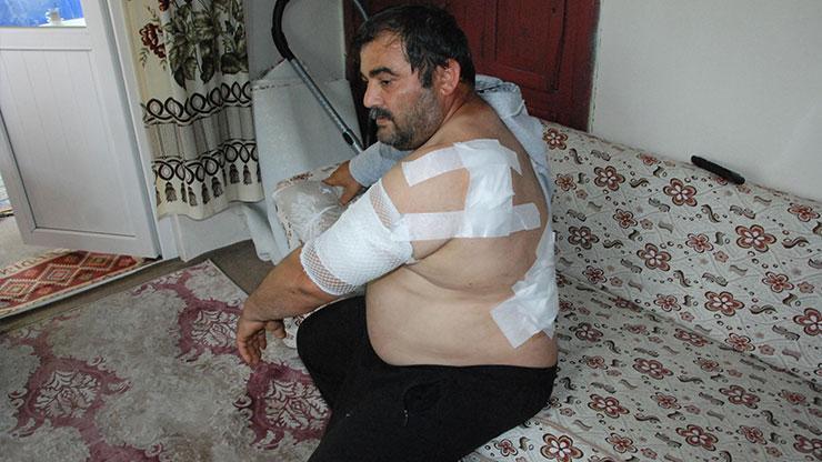 Bartında ayı saldırısı Korku dolu anları anlattı: Öldüğümü sanıp bıraktı