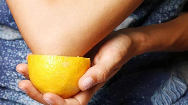Dirseklere limon sürmenin mucize etkisi