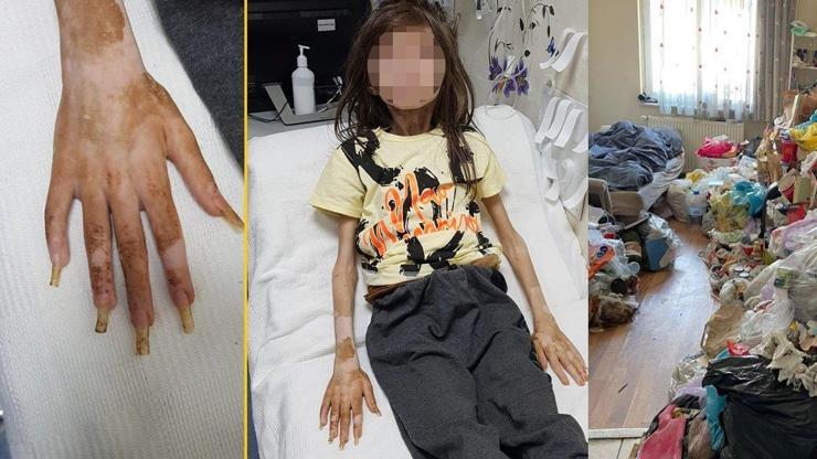 Türkiye bu olayı konuşuyor… Bursa’da çöp evde bulunan çocuğun ilk sözleri ortaya çıktı