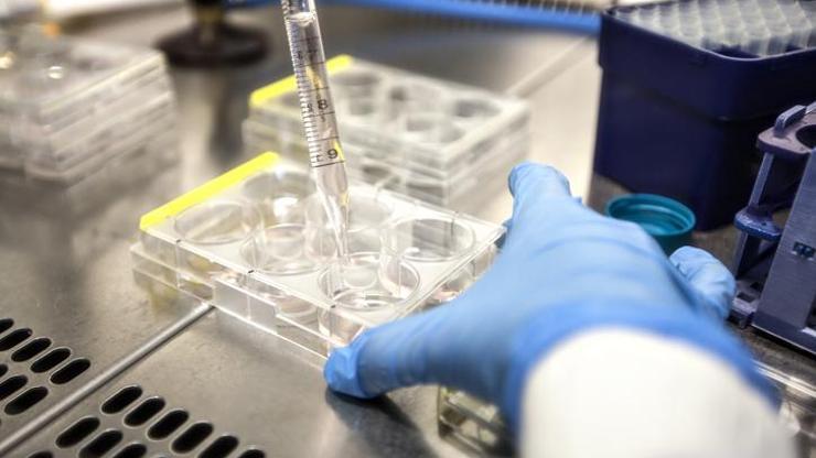 İtalyada dikkat çeken vaka: Aynı gün maymun çiçeği, Covid-19 ve HIV testi pozitif çıktı