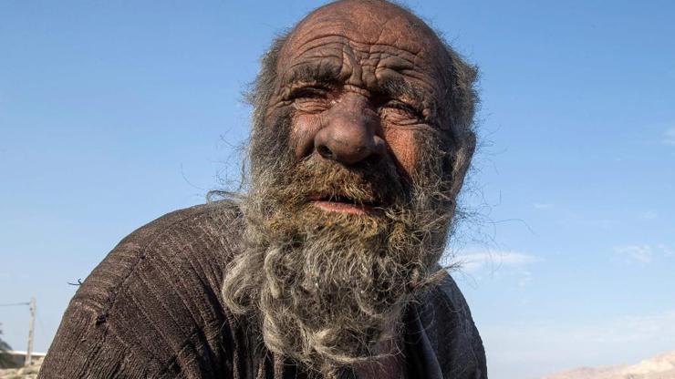 İran’da yaklaşık 70 yıldır yıkanmayan adam, banyo yaptıktan haftalar sonra öldü