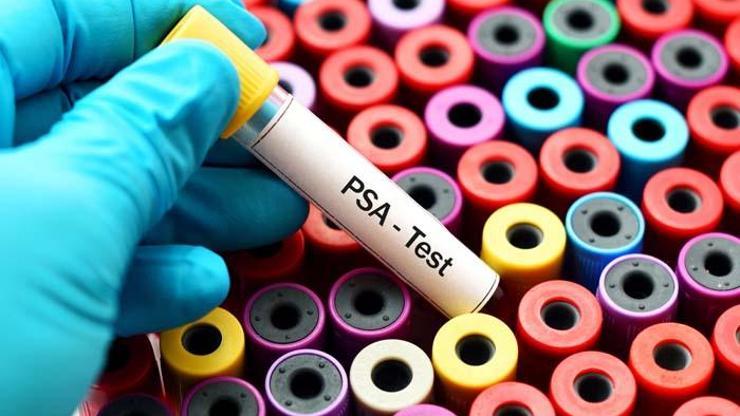 Prostat kanseri erken evrede belirti göstermiyor