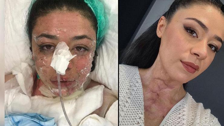 Gizem hemşire acil serviste dehşeti yaşadı Çakmak çakıp Yakayım mı sizi diye sormuş: Kendini böyle savundu