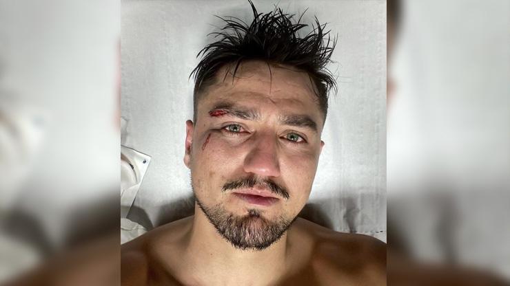 Cengiz Ünder ölümden döndü Şok görüntü