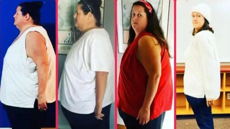 Günde 10 bin kalori tüketiyordu... Dünyanın konuştuğu değişim: 5 yılda 190 kilo verdi
