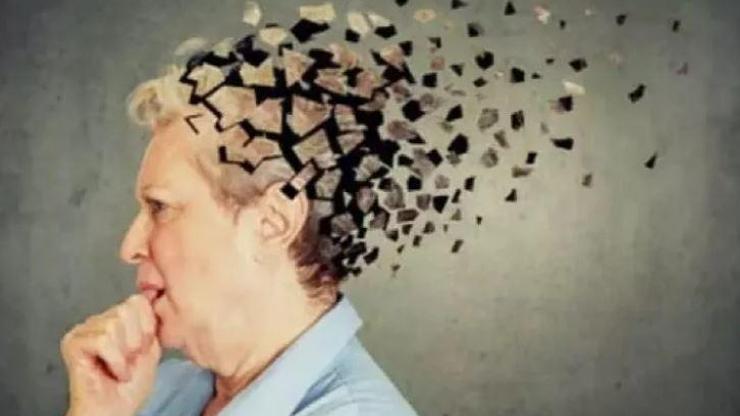 Alzheimer kadınlarda daha çok görülüyor