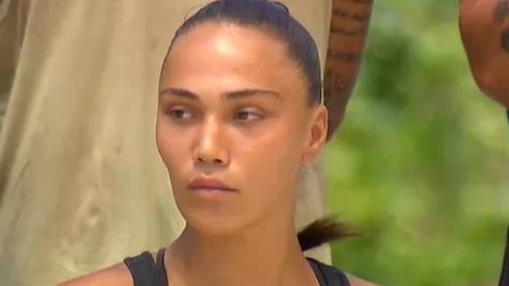 Patella diz dönmesi Survivor Kardelenin patellası döndü Patella nedir Patella çıkığı ne anlama gelir
