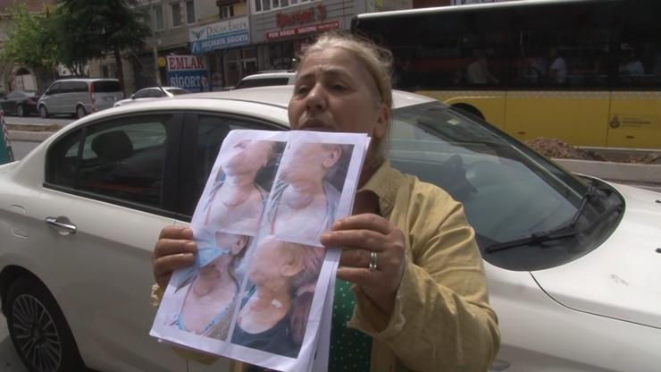 Diş tedavisine giden kadın kâbusu yaşadı: Narkoz sonrası yoğun bakıma alındı