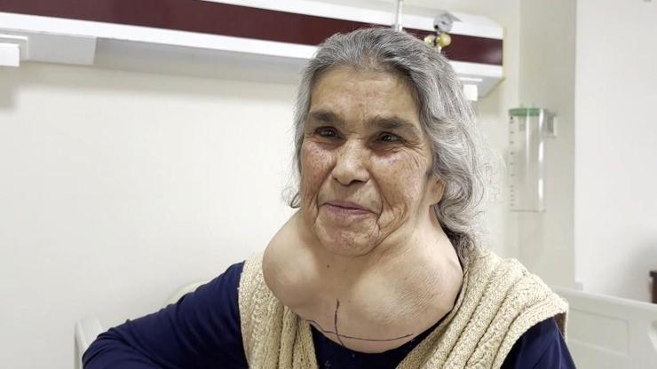 50 yıl devasa kitleyle yaşadı İşte nedeni