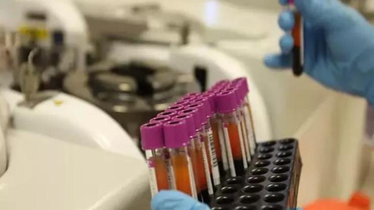 Karabük İl Sağlık Müdürlüğünden HIV ve HPV pozitif vakalarında artış iddiasına yalanlama