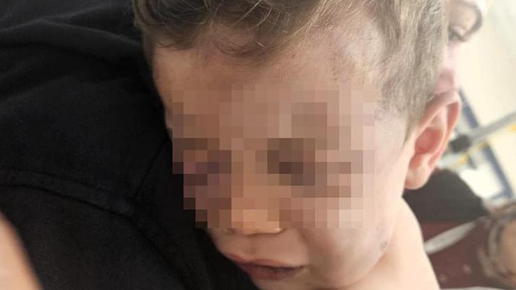 Denizli’de 2 yaşındaki bebek darp edildi Hayati tehlikesi devam ediyor...