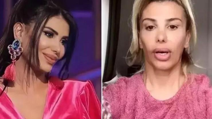Şarkıcı Hatice: İkinci eşim Ramiz resim çerçevesini kafamda kırdı