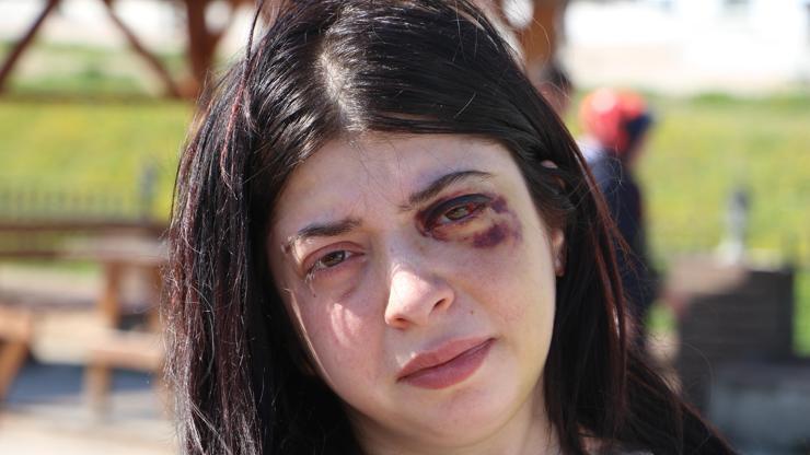 Sokak ortasında darbedilen Damla: Platinler hep yüzümde kalacakmış