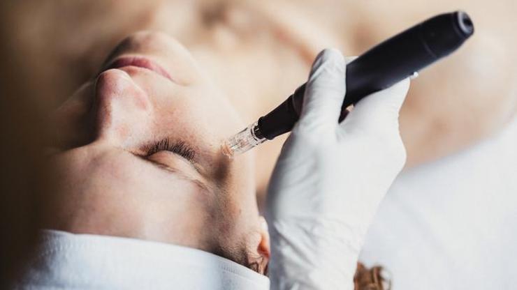 Dermapen Nedir, Ne İşe Yarar Dermapen Tedavisi Nasıl Uygulanır