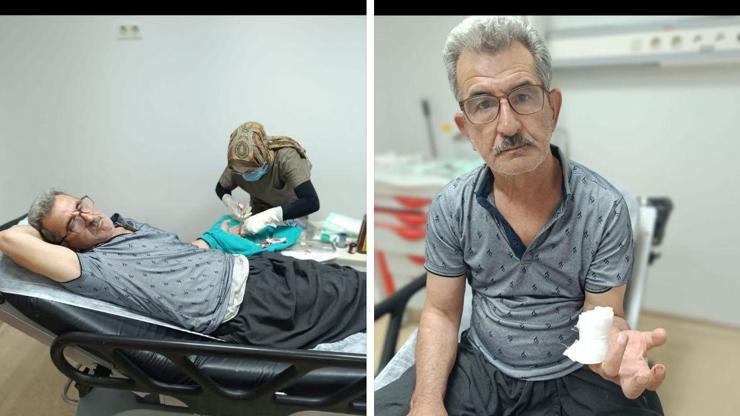 Karpuz keserken parmağını kesti