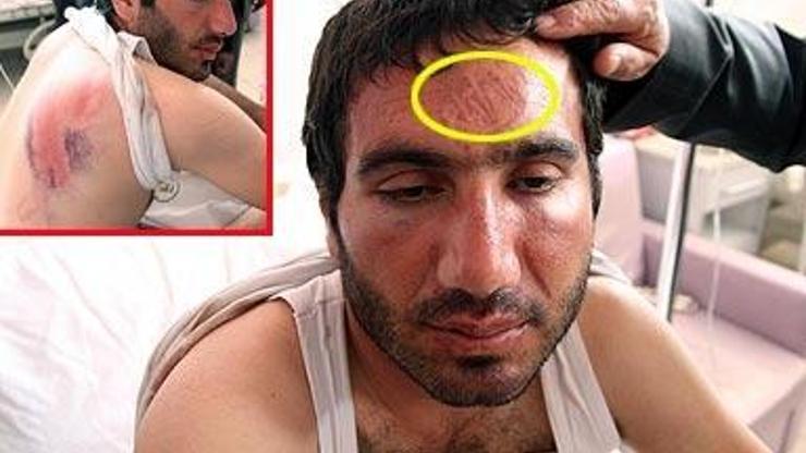 Bismilde öğrenci velisine polisten işkence