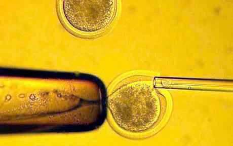 Organ klonlamaya bir adım daha yaklaşıldı