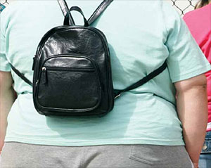 Obezite kanserin önde gelen nedeni olabilir Obezite kanserin önde gelen nedeni olabilir