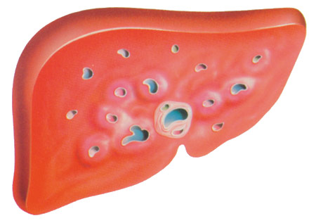 Hepatit B Veba Salgınından daha yaygın