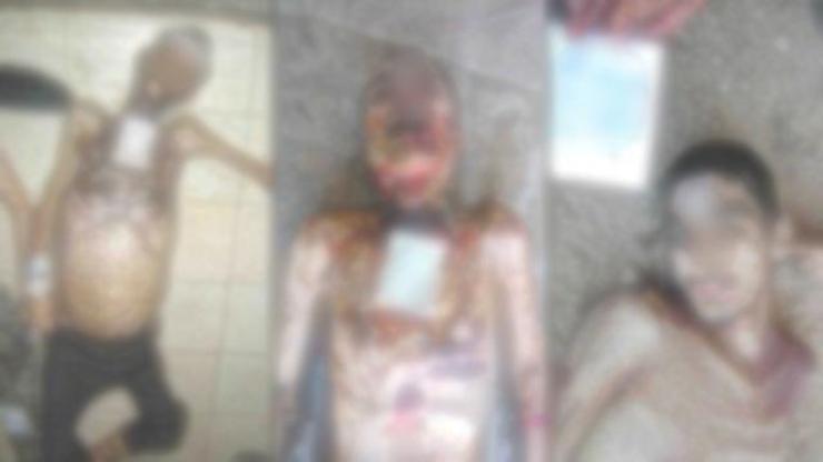 Suriyede işkence fotoğrafları