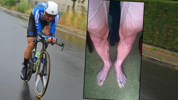 Bisikletçi Bartosz Huzarskinin bacakları şaşkınlık yarattı