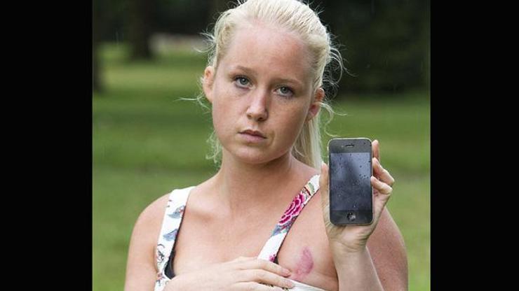 Şarjdaki iPhone genç kadının göğsünü yaktı