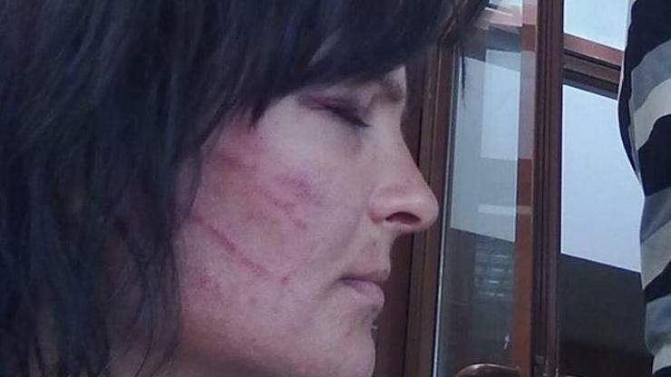 Fevziye Cengizin dövülmesinde 2 polise hapis cezası