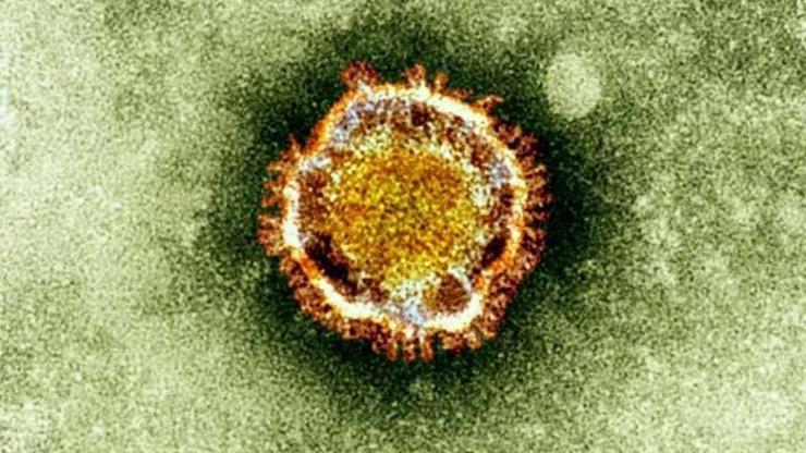 Türkiyede corona virüsünden ölüm