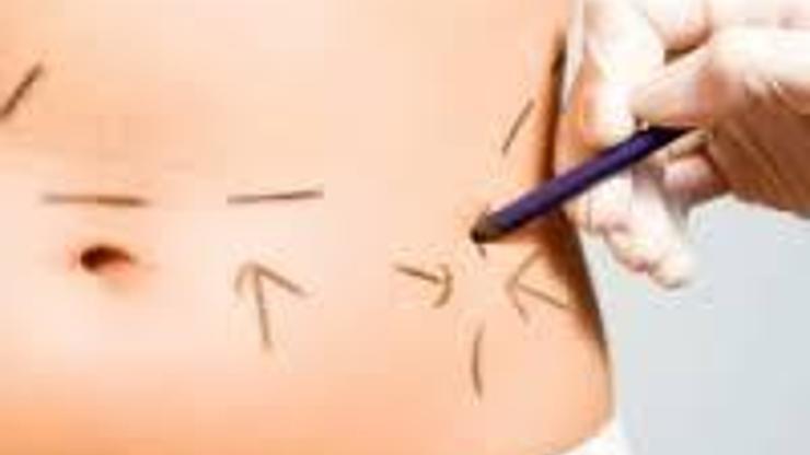 Lazer liposuction nedir