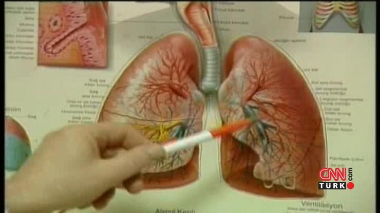 Akciğer kanserinde en yüksek risk sigara ve tütün kullanımı