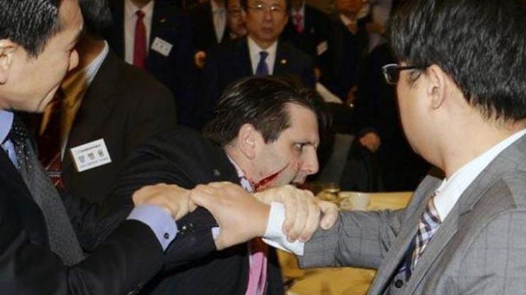 ABDnin Seul Büyükelçisi Mark Lipperta usturalı saldırı