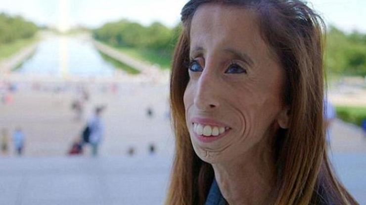 Dünyanın en çirkin kadını belgeselini yaptı