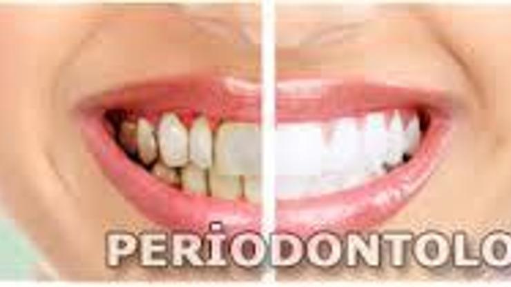 Periodontoloji nedir