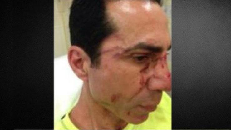 CHPli meclis üyesine saldırı