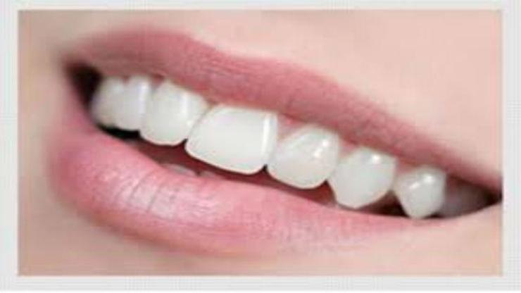 Estetik diş tedavisinde öncelikler nelerdir