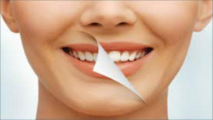 Estetik diş tedavisinde diş etinin önemi