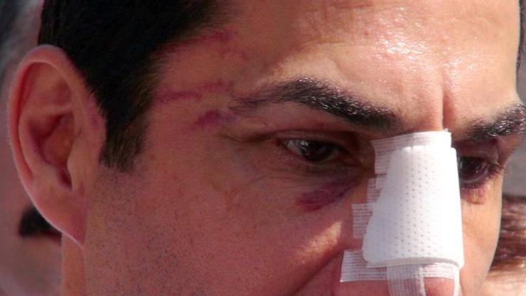 CHPli Hüseyin Sağa saldırıda iki gözaltı