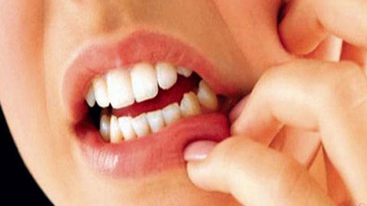 Diş eti çekilmesi nedir Nasıl tedavi edilir