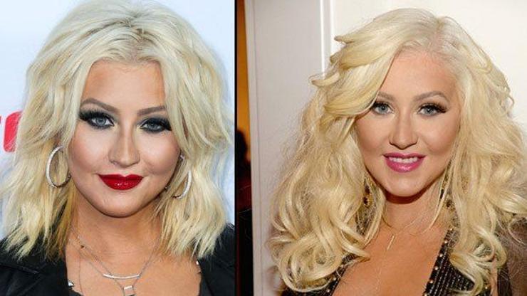 Christina Aguileranın yüzüne ne oldu