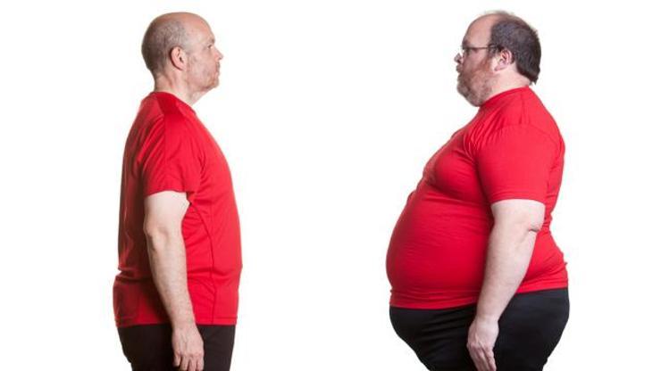 Obezite cerrahisi sonrası normal hayata ne zaman dönülür