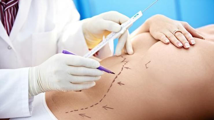 Lazer liposuction avantajları nelerdir